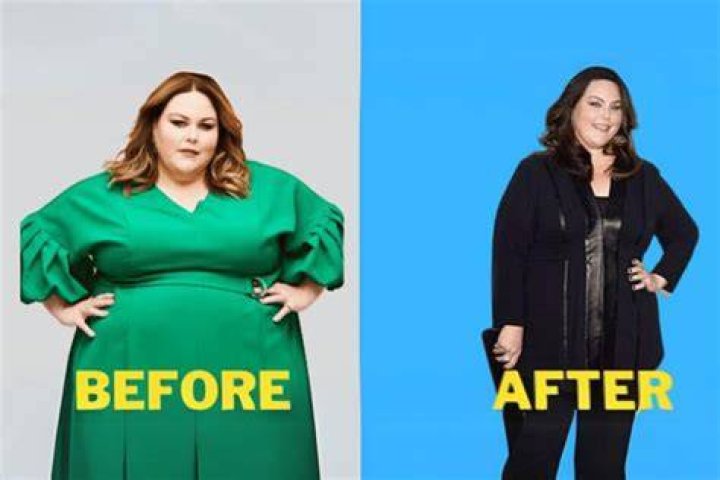
Did Chrissie Swan Had Weight Loss Surgery? Before And After 