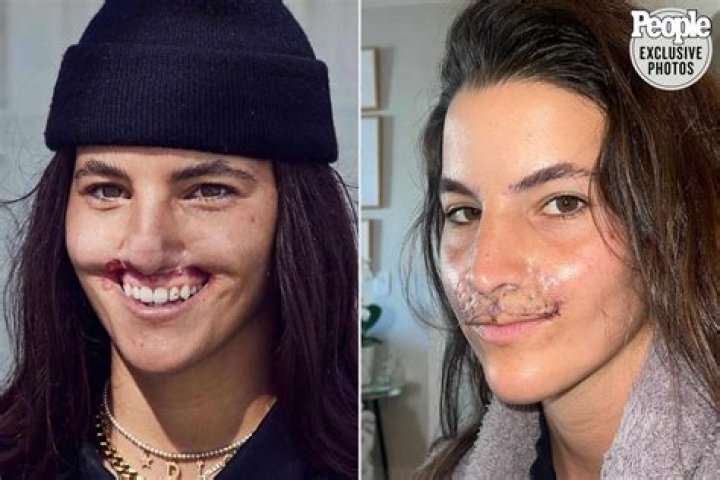 Did Dana Loesch Undergo Surgery? Illness And Health Update 2022 – What Happened To Her?