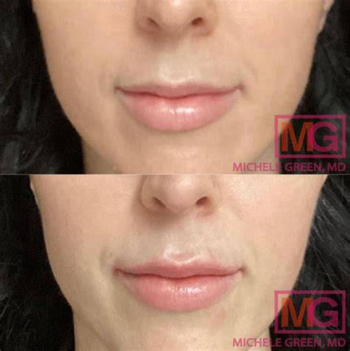Has Ashley Park Done Plastic Surgery? Fans Suspect Botox And Lip Fillers!