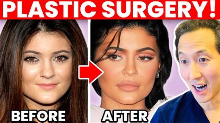 
Has Jared Leto Had Plastic Surgery? Who is Jared Leto? 
