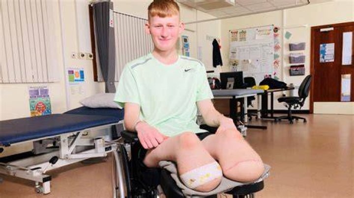 How Did Ray Barnett Lose His Legs On ER? Here’ What Happened Exactly