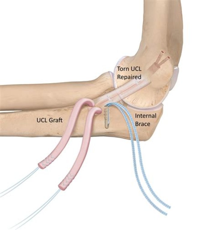 
How Old Is Tommy John Son? Tommy John III Career Details Explored 
