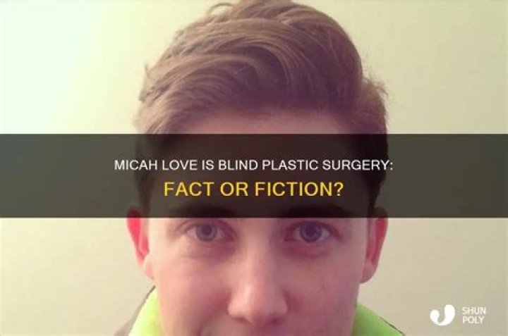 Micah Love Is Blind Plastic Surgery and Lips Transformation
