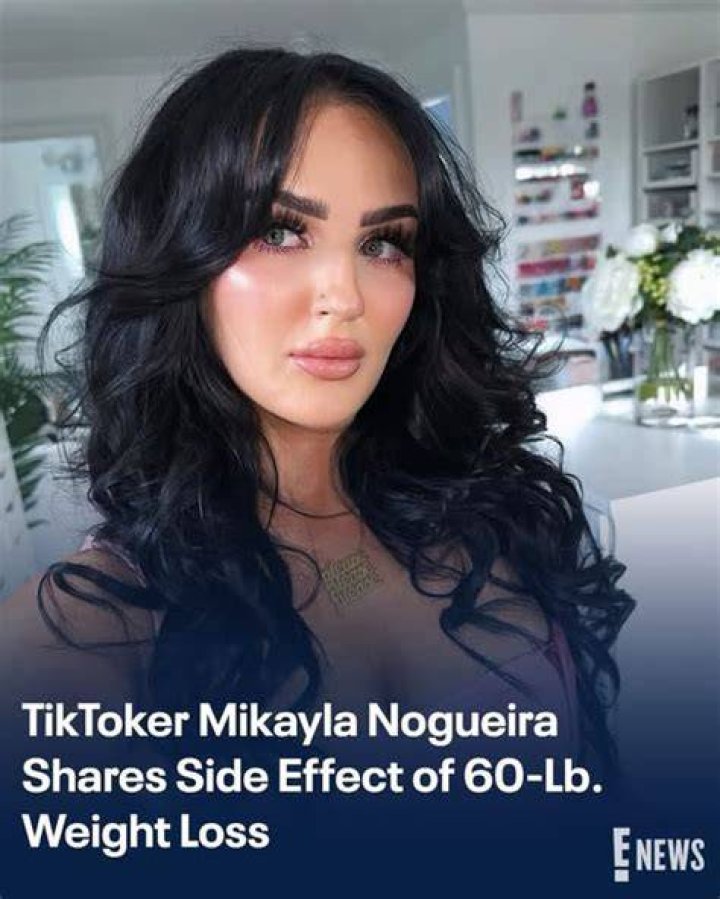 Mikayla Nogueira Weight Loss Viral On TikTok: Has She Done Surgery; Health Update