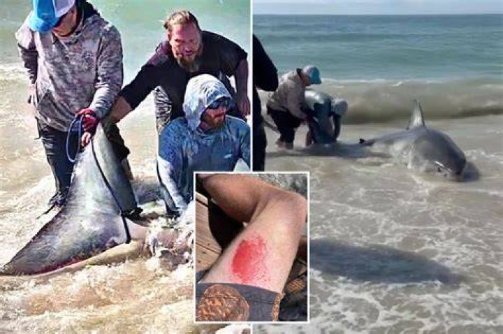 
Who is Jameson Reeder? What happened to his lower right leg? Attacked by Shark 